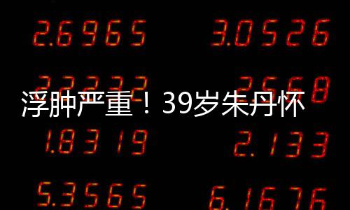 带货怀孕朱丹直播严重月 7个浮肿9岁深夜坚持