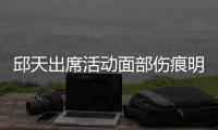 邱天出席活动面部伤痕明显 曾被曝休学生子